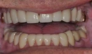 second image