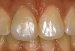 second image