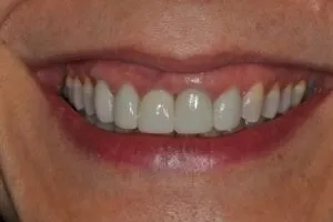 second image