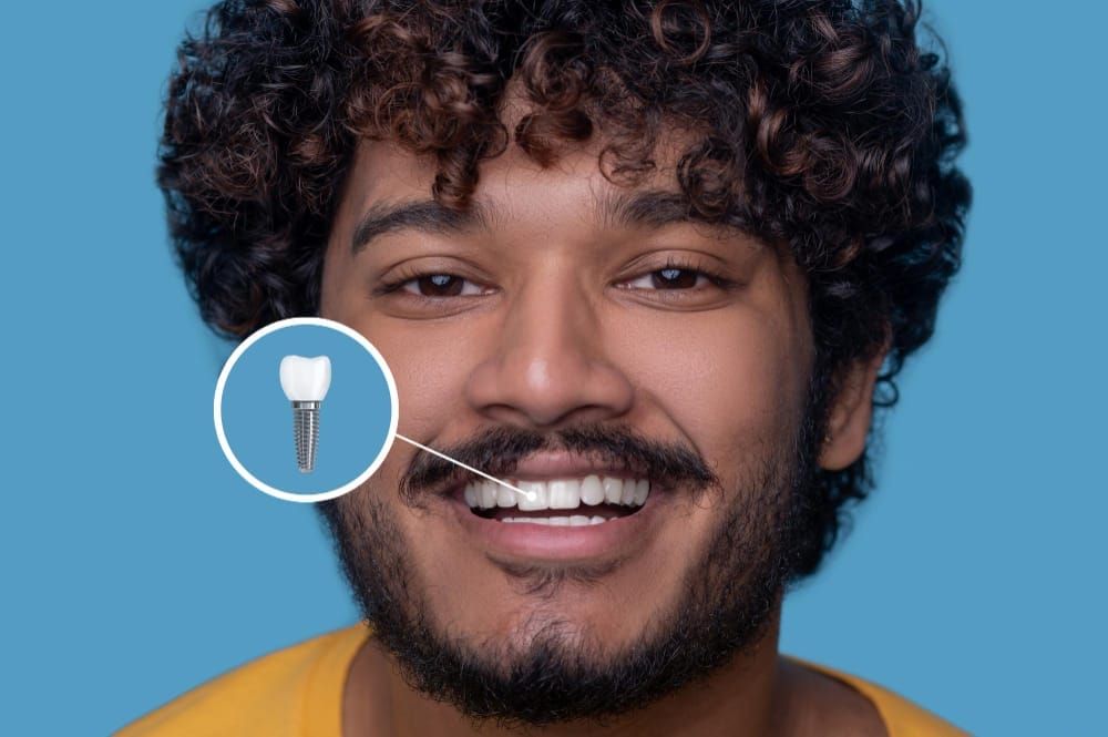 Who Is a Good Candidate for Dental Implants?