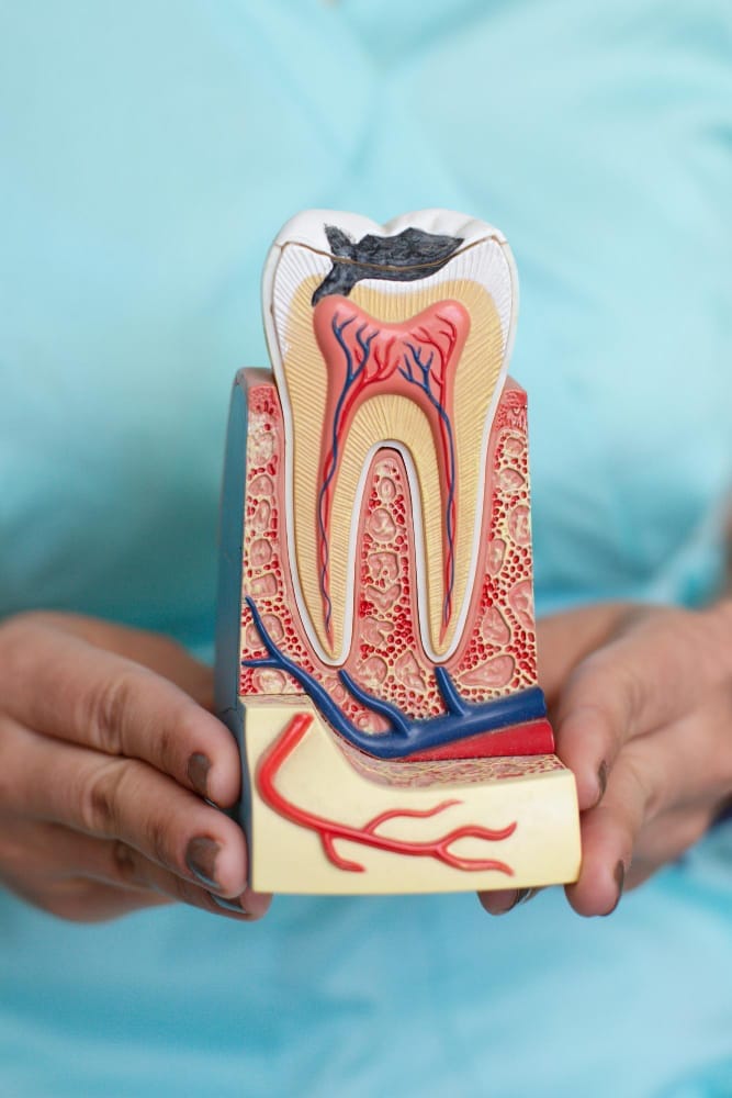 Alternatives to Root Canal Therapy