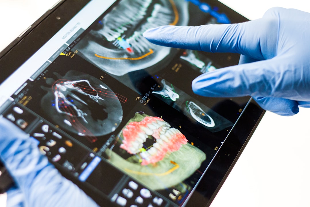 Dentist reviewing a dental X-ray showing bone level around tooth roots