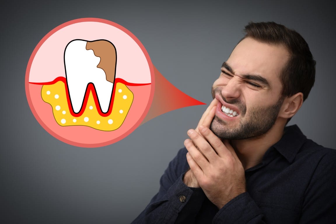 Are Teeth Hollow? What's Actually Inside Your Tooth