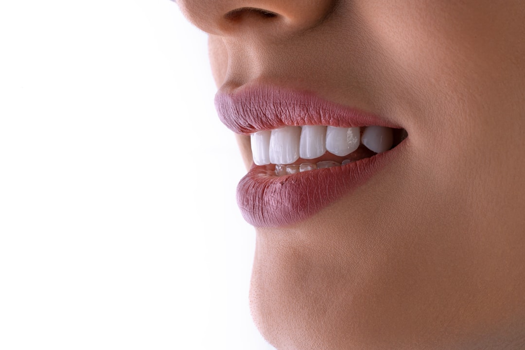 Close-up of a confident, naturally bright white smile after professional teeth whitening in Berkeley