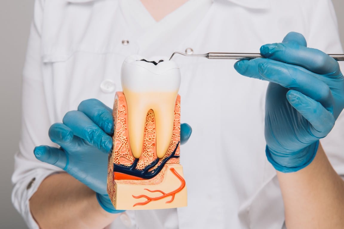 Root Canal Aftercare — How to Heal Faster (Day-by-Day Guide)