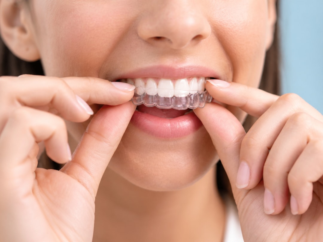 Clear Braces in Berkeley: What Adults Actually Pay and How Long It Takes