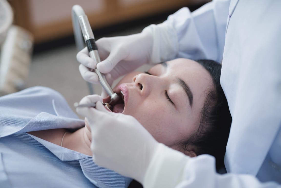 Filling Still Hurts? Why Pain After a Filling Is Normal