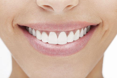 Smiling mouth with veneers from Anthony Dailley, DDS