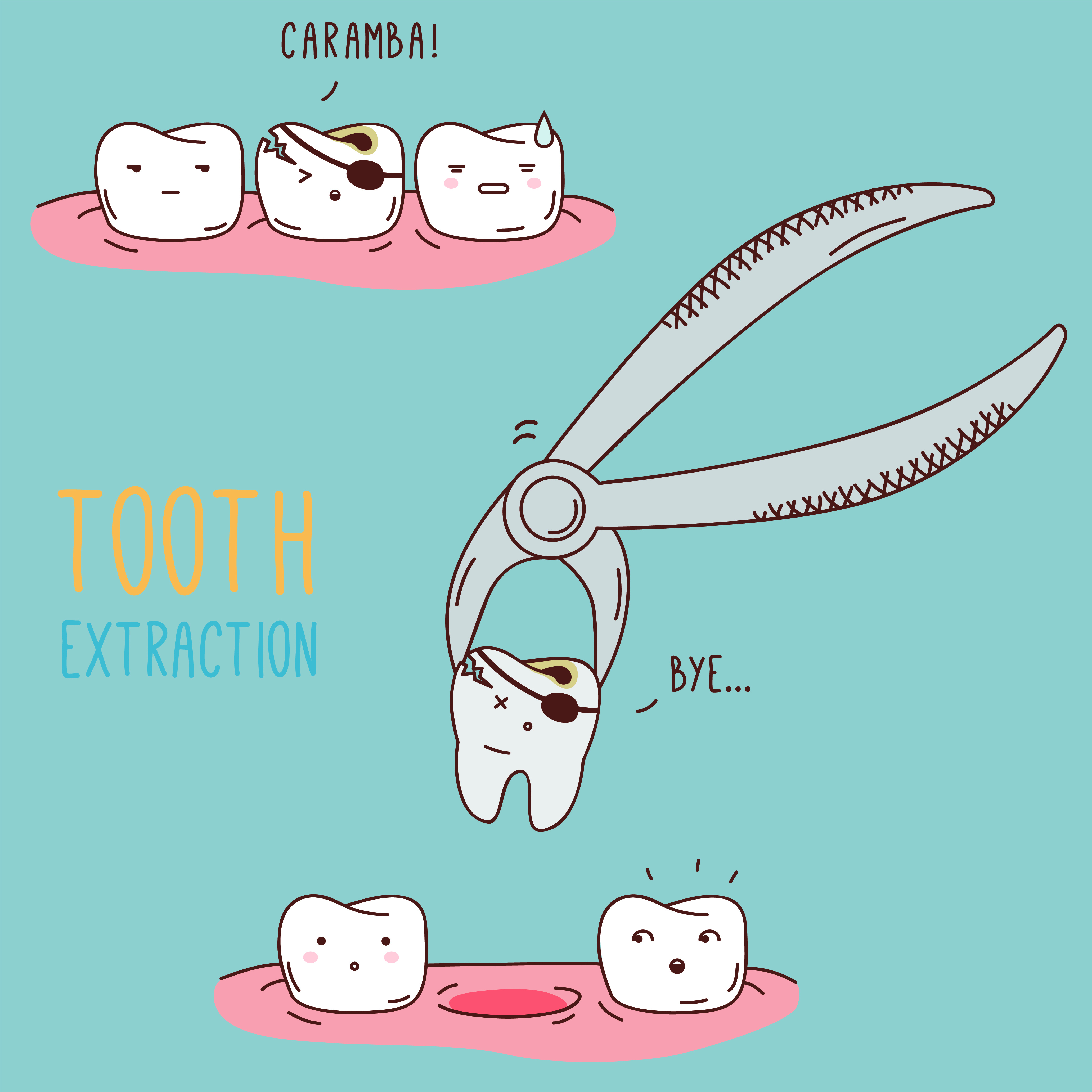 Tooth Extraction graphic from Dailley Dental Care 