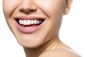 Porcelain Veneers in Berkeley, CA